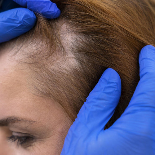 K18 Treatment